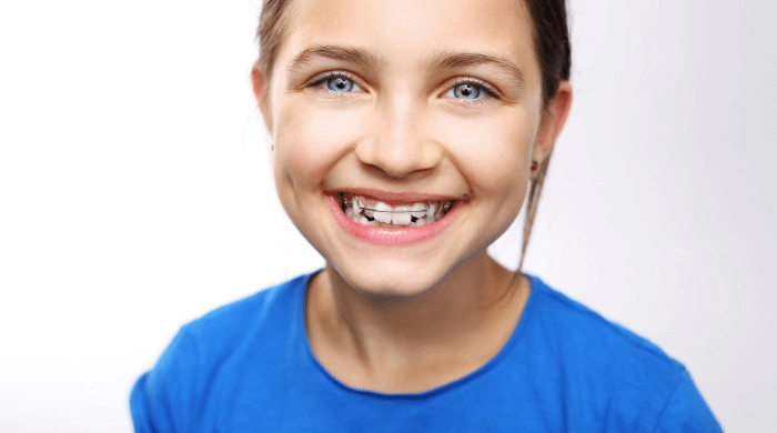 子供の歯列矯正の費用相場と内訳