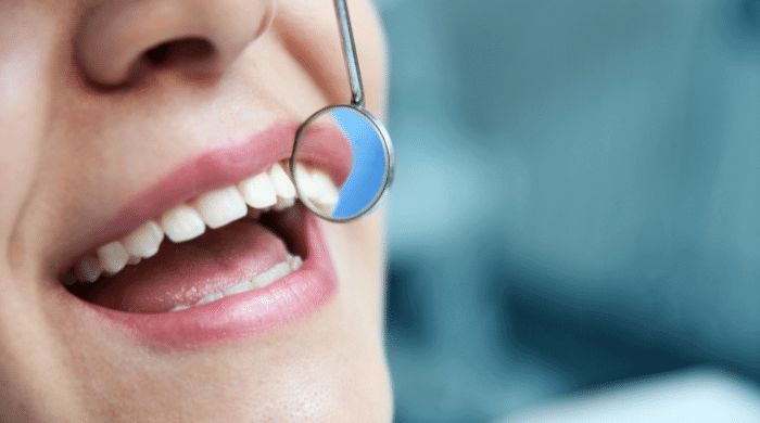 【前歯だけの部分矯正】治せる5つの歯並び